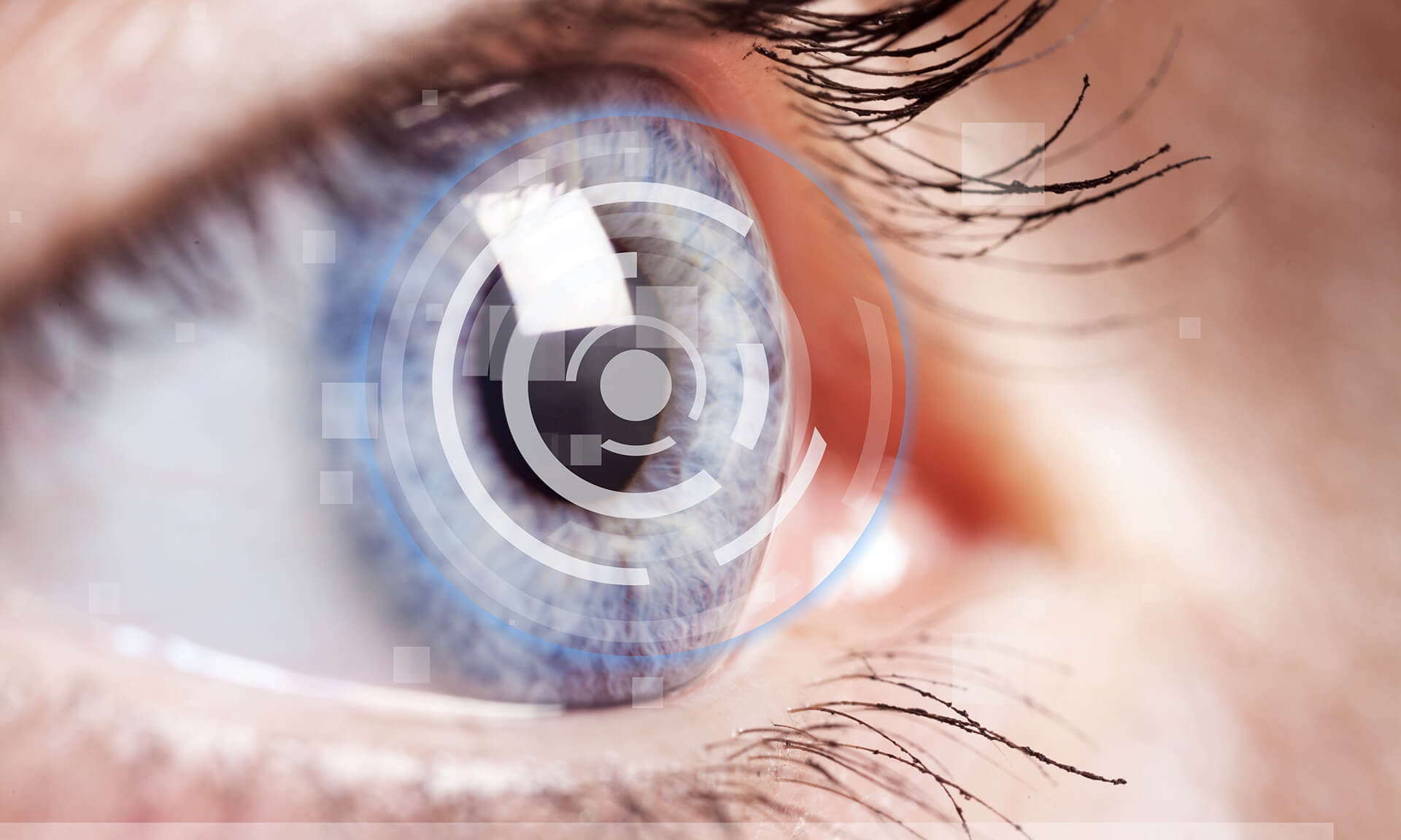 cataract lens types